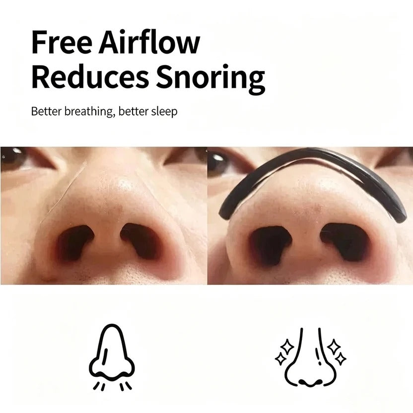 AirFlow Nasal Dilator